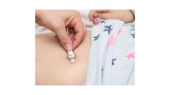 The Feeding Tube Onesie: Expections vs. Reality